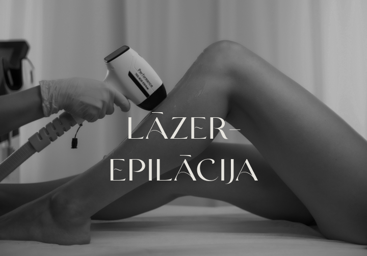Lāzerepilācija